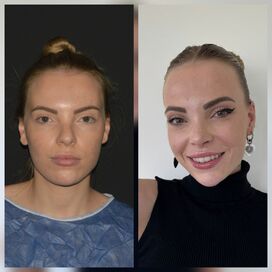 Marilena, waarom Esteworld voor mijn Neus en borsten?
