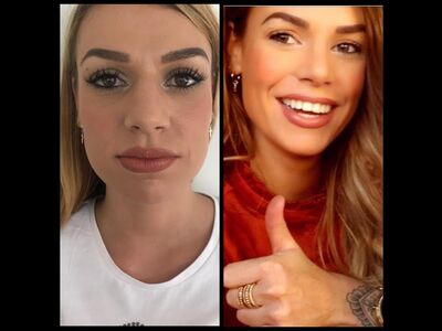 Rachel, neuscorrectie Turkije