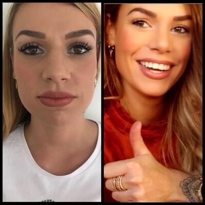 Rachel, neuscorrectie Turkije