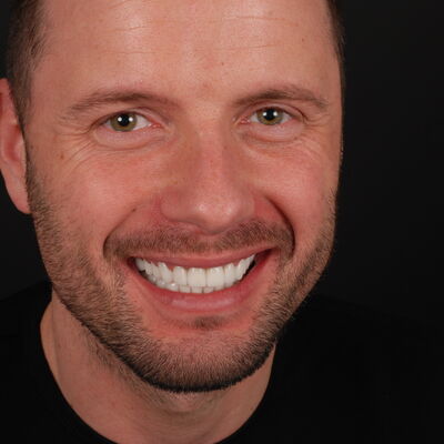 Nieuw gebit voor Gordon in Turkije