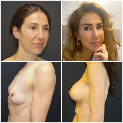 Zeer fijn gevoel bij Esteworld, vertrouwd en professioneel