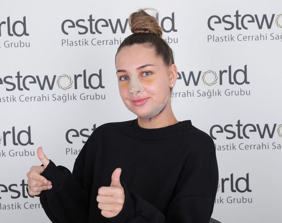 neuscorrectie-Turkije-Esteworld