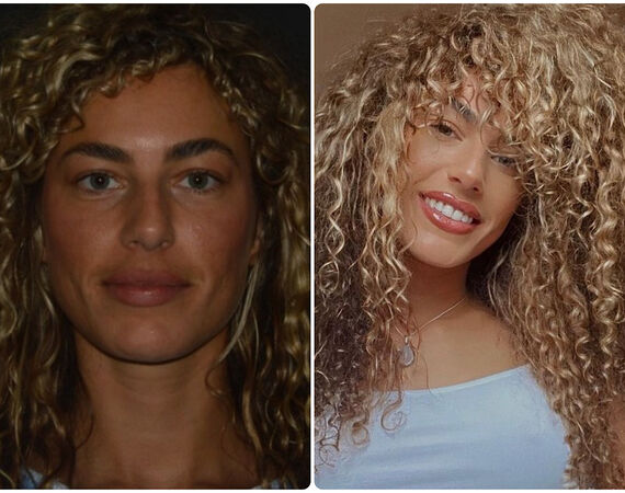 Neuscorrectie Turkije