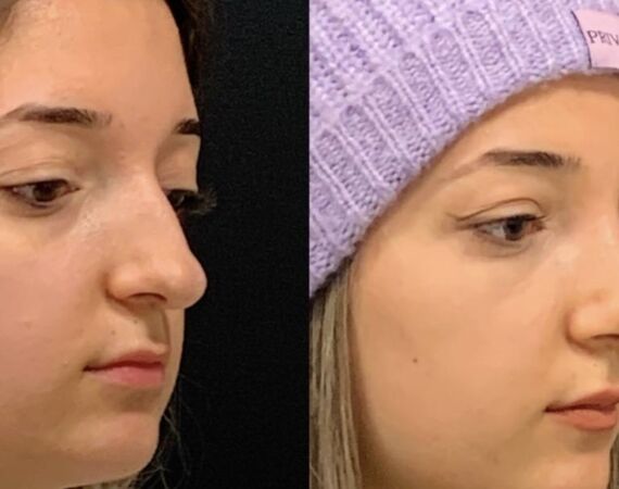 Op. Dr. Bükem CÜCE