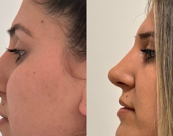 Op. Dr. Bükem CÜCE