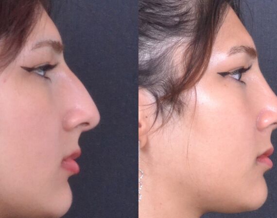 Op. Dr. Bükem CÜCE