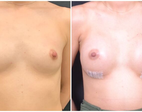 Op. Dr. Bükem CÜCE