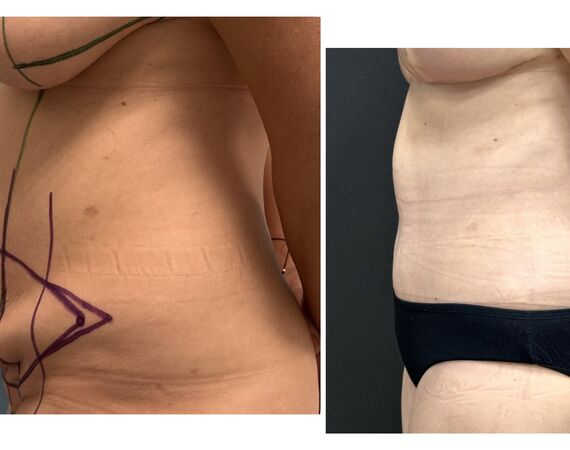 Op. Dr. Bükem CÜCE