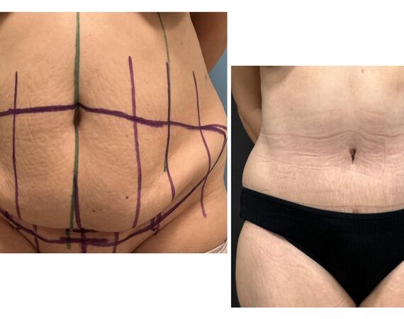 Op. Dr. Bükem CÜCE