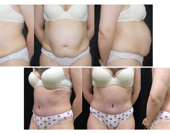 Op. Dr. Bükem CÜCE