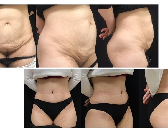 Op. Dr. Bükem CÜCE