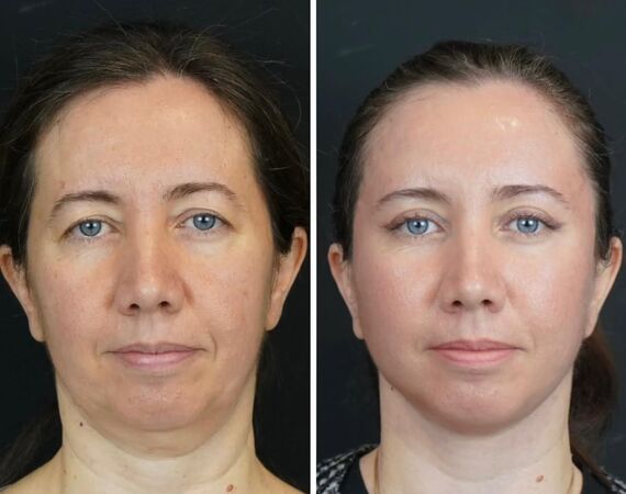 Op. Dr. Bükem CÜCE