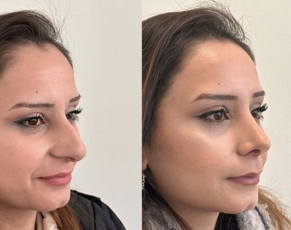 Op. Dr. Bükem CÜCE