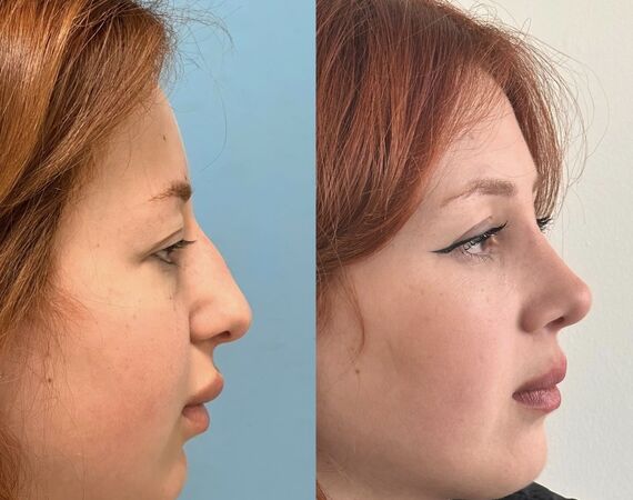 Op. Dr. Bükem CÜCE