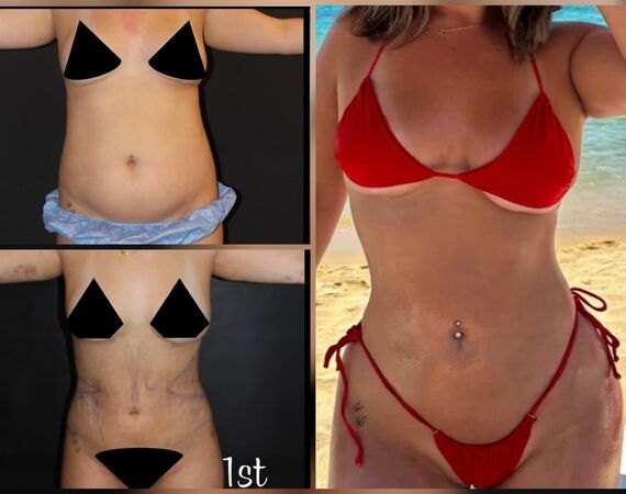 Op. Dr. Bükem CÜCE