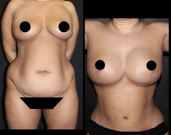 Op. Dr. Bükem CÜCE