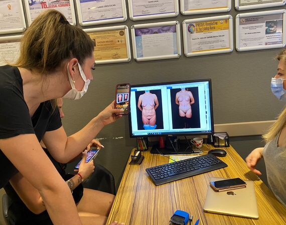 Buikwandcorrectie Istanbul