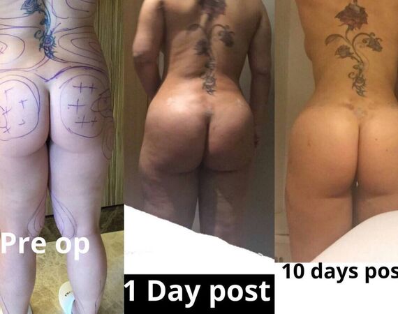 Braziliaanse bilvergroting Turkije