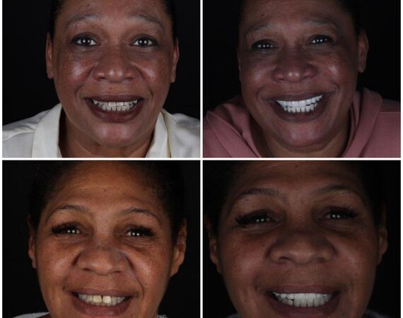 Gebits-makeover Istanbul