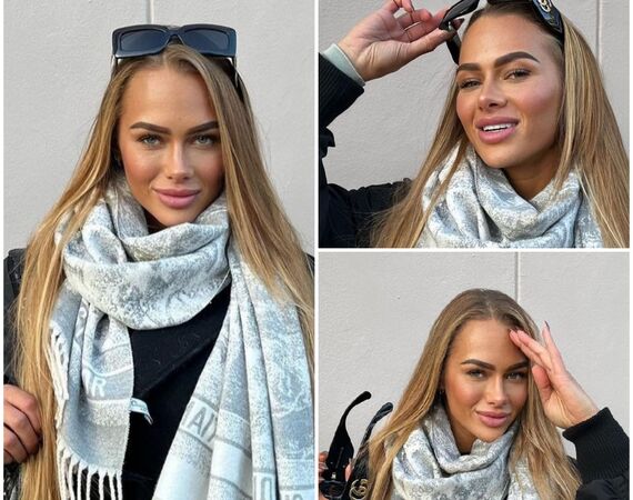 Annebel Visscher voor neuscorrectie bij Esteworld