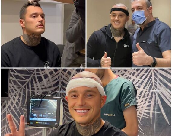 Shani van Hoey en Davey Schniermanni voor borstlift en haartransplantatie bij Esteworld