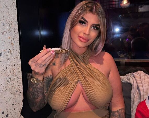 Shani van Hoey en Davey Schniermanni voor borstlift en haartransplantatie bij Esteworld