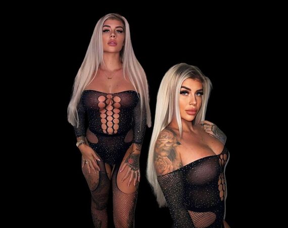 Shani van Hoey en Davey Schniermanni voor borstlift en haartransplantatie bij Esteworld