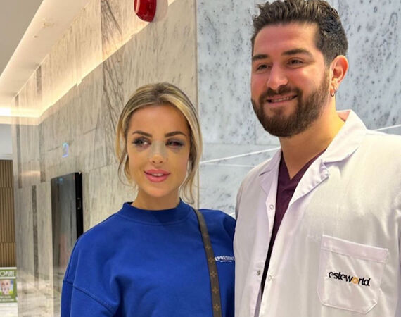 Influencer @eilishflesch voor Neuscorrectie naar Esteworld