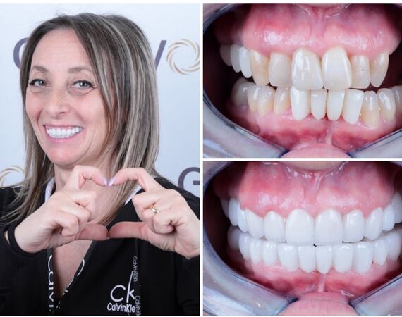 Tandarts Turkije: Een overzicht van de voordelen en nadelen