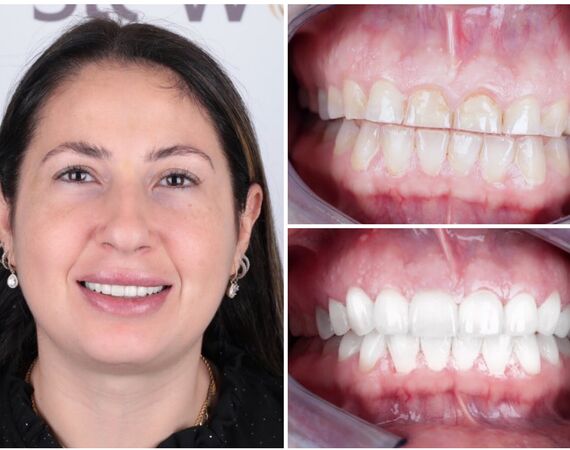 Tandarts Turkije Mislukt