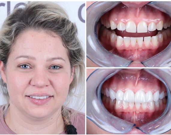 Voor de tandarts naar Turkije