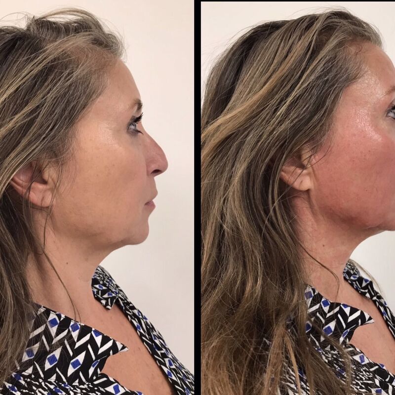 Jullie staan altijd klaar voor me, bedankt!