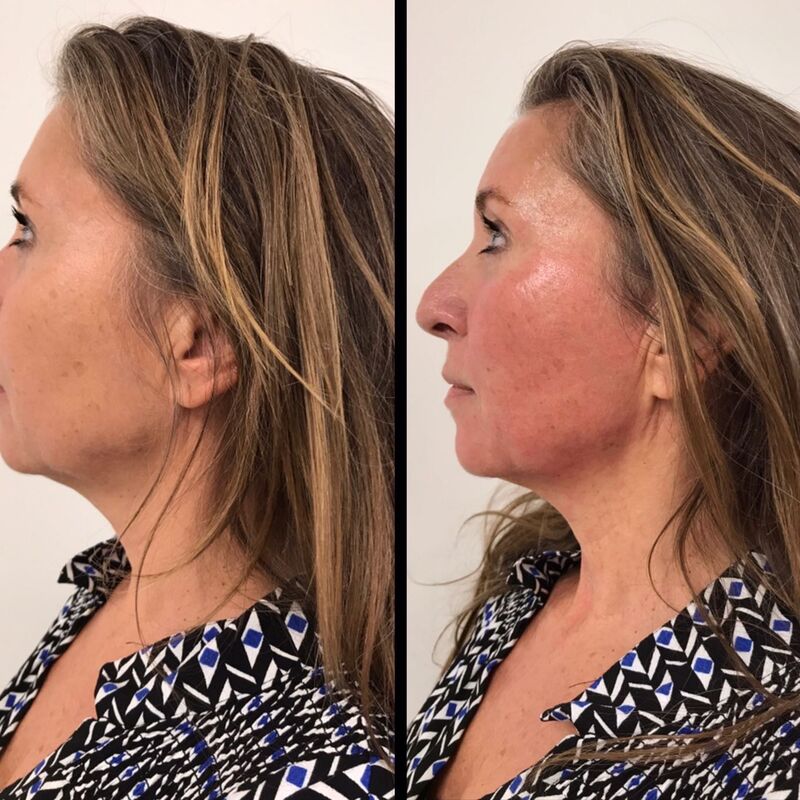 Jullie staan altijd klaar voor me, bedankt!