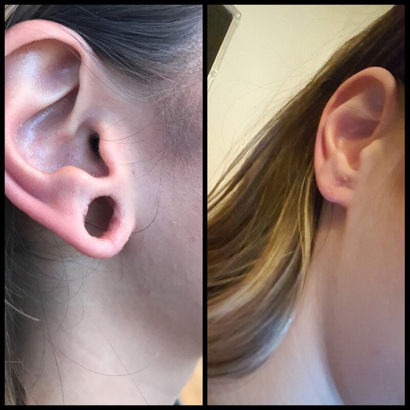 Rosa, wat ben ik blij met mijn neus!