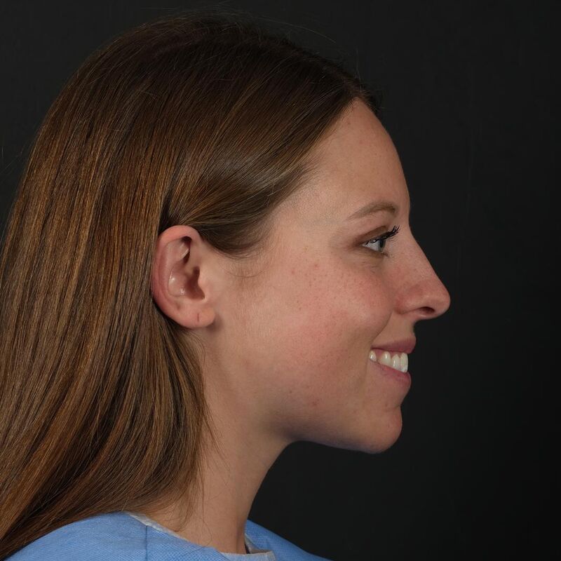 Erg meegevallen,super tevreden!