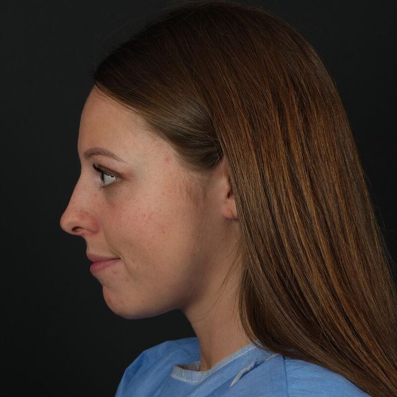 Erg meegevallen,super tevreden!