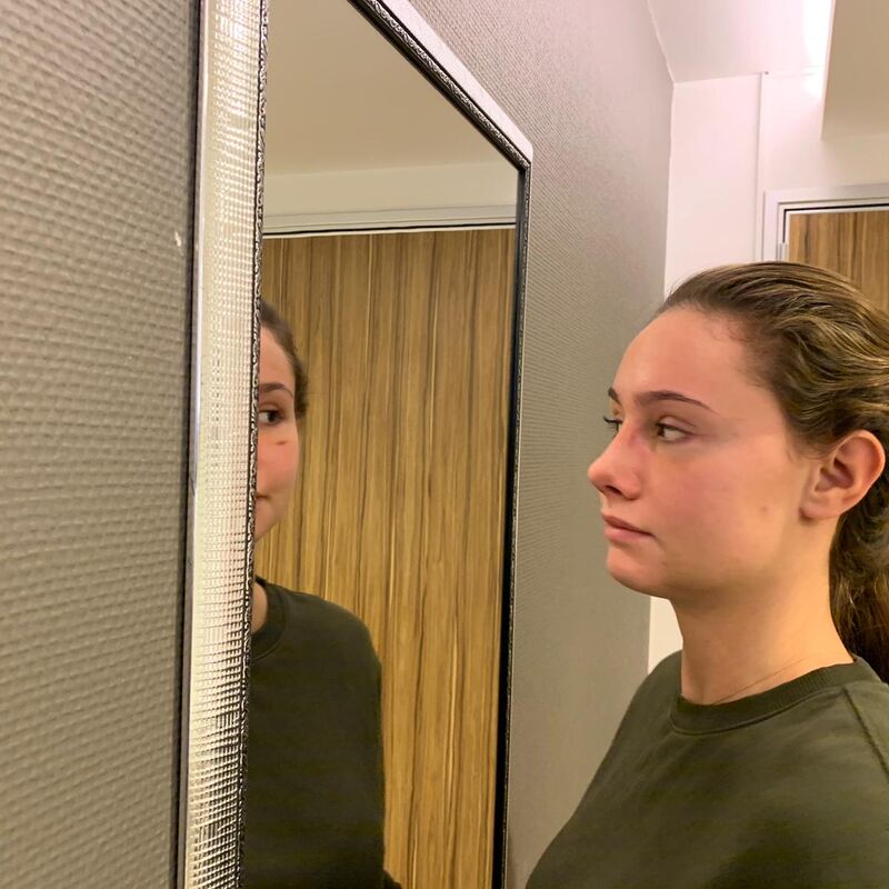 Marielle, voor een neuscorrectie moet je bij Esteworld zijn.