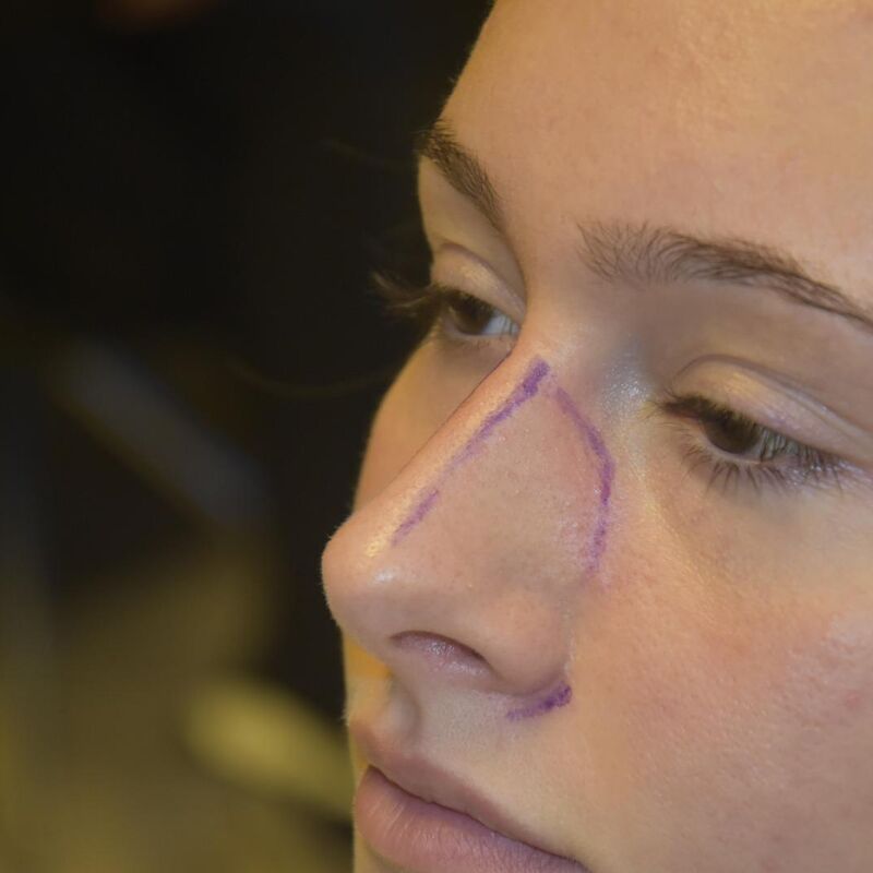 Marielle, voor een neuscorrectie moet je bij Esteworld zijn.