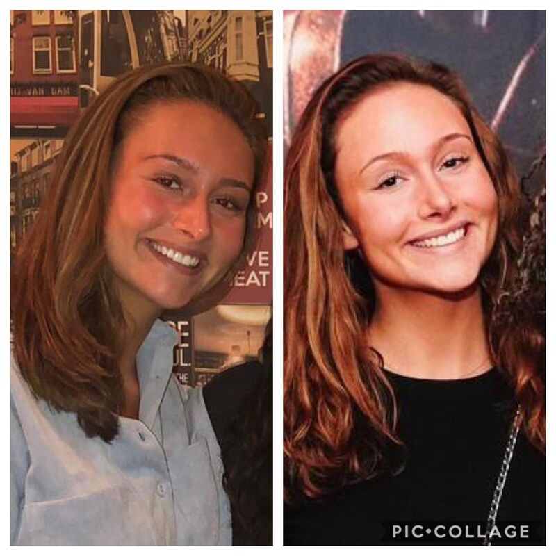 Marielle, voor een neuscorrectie moet je bij Esteworld zijn.