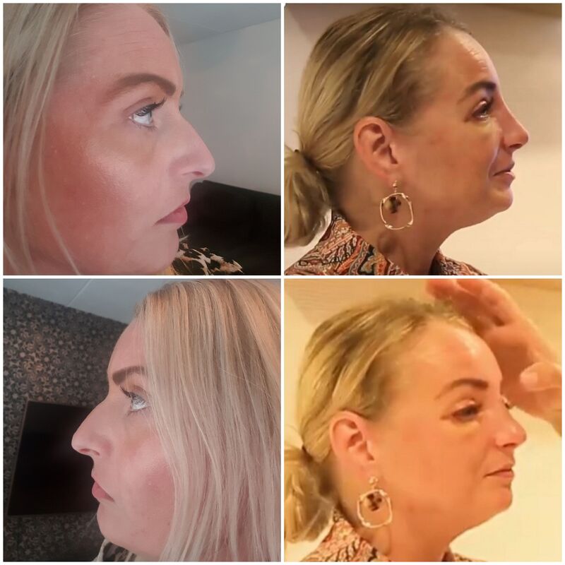 Ramona, erg goed geregeld en NL begeleiding.