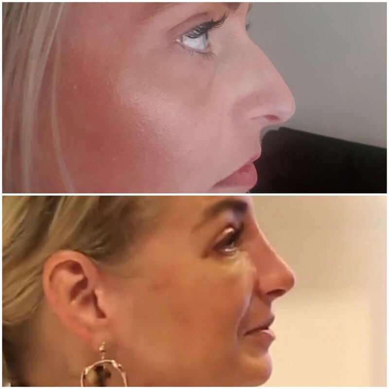 Ramona, erg goed geregeld en NL begeleiding.