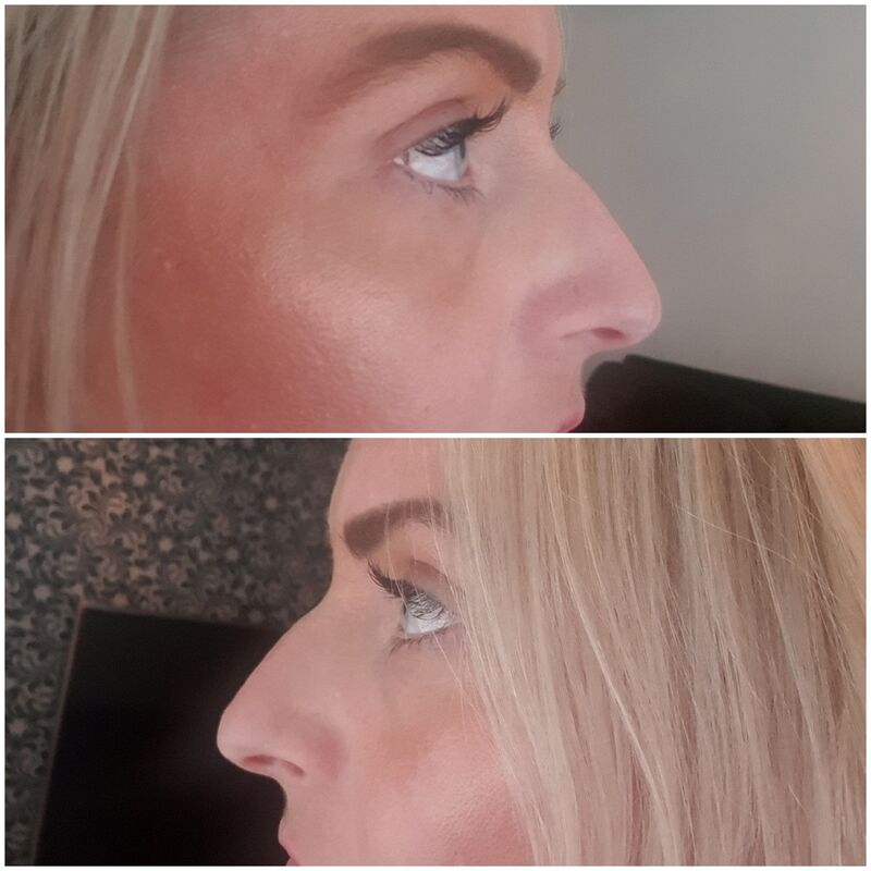 Ramona, erg goed geregeld en NL begeleiding.