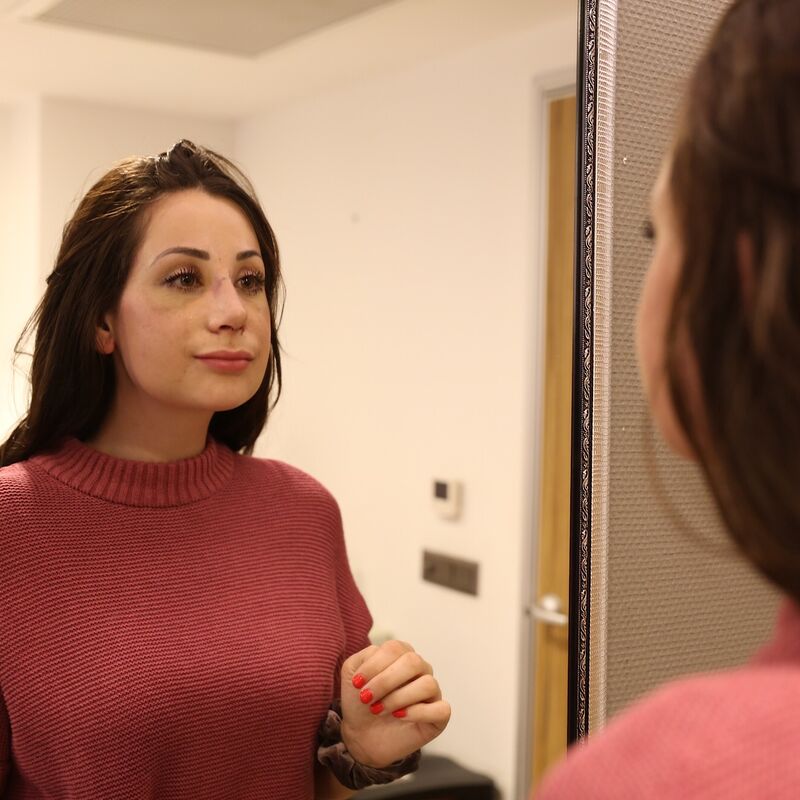 2 zusjes neuscorrectie bij Esteworld