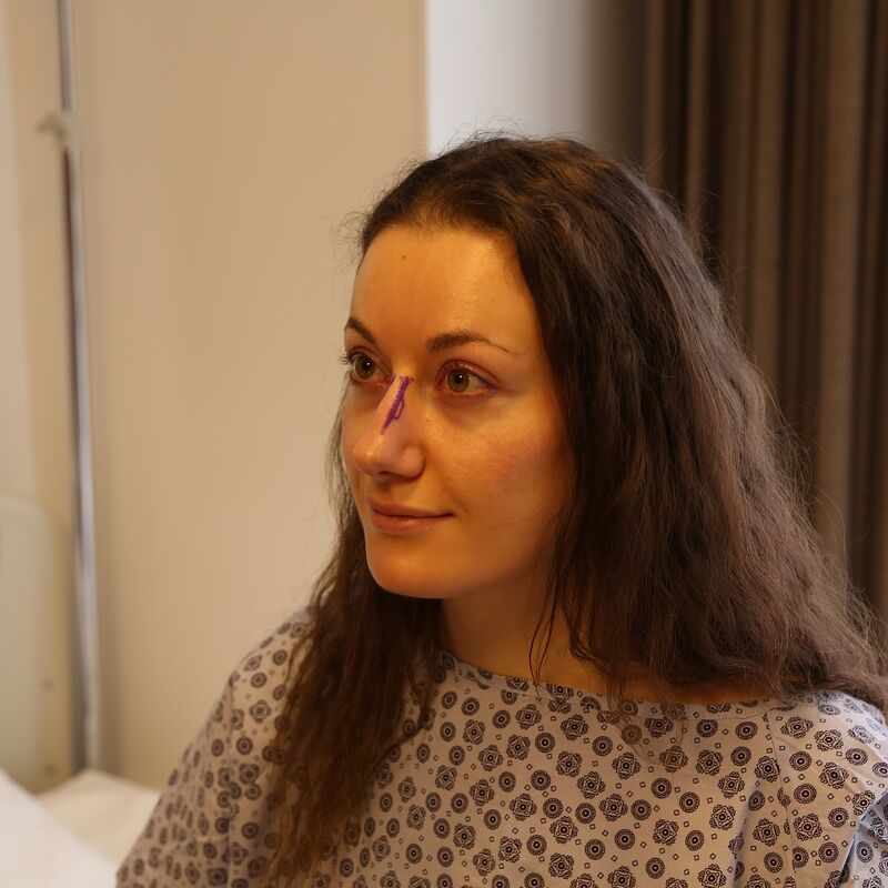 2 zusjes neuscorrectie bij Esteworld