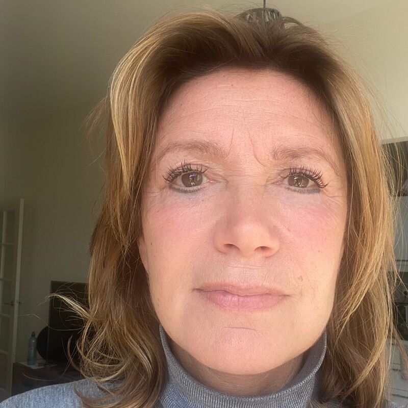 Corina facelift bij Esteworld