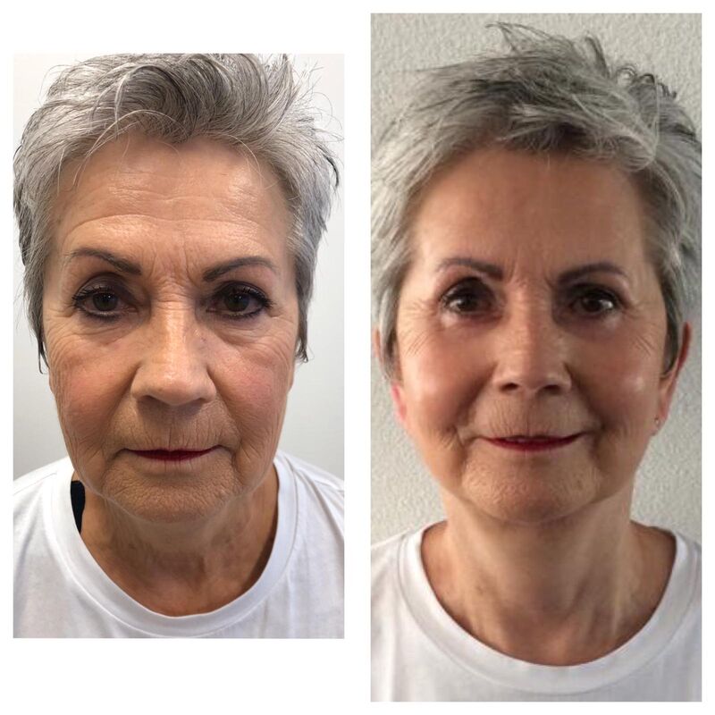 Verbluffende facelift Turkije