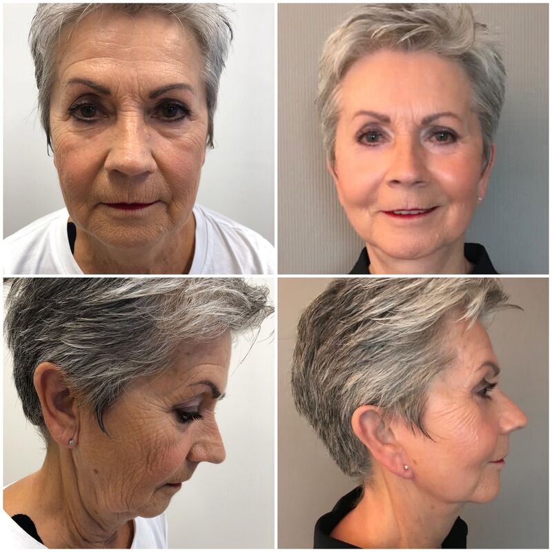 Verbluffende facelift Turkije