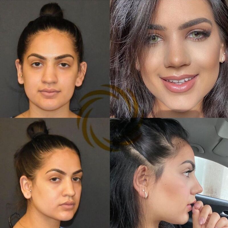 Bij Esteworld NL word alles voor je geregeld 