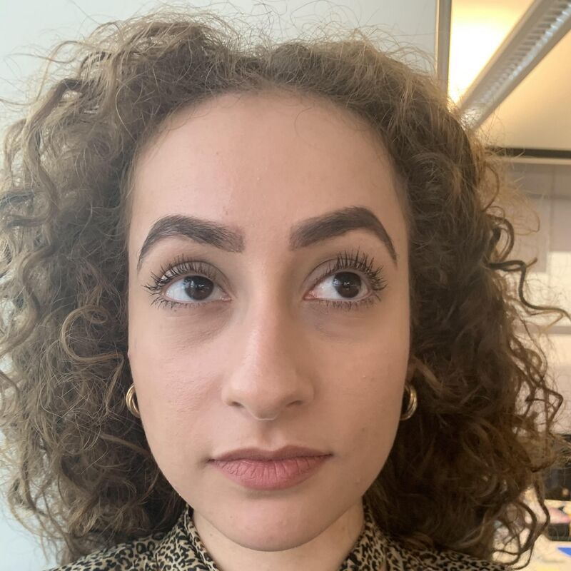 Betul super blij met neuscorrectie