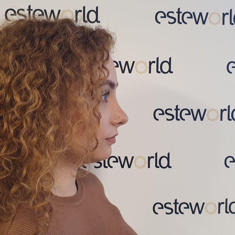 Betul super blij met neuscorrectie